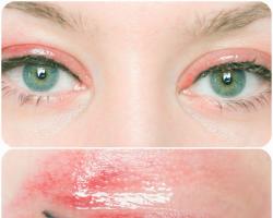 Care after eyelid tattooing or what to smear the eyelids in the first days after the tattoo procedure. What to smear after eye tattooing