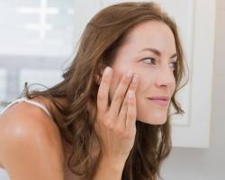 Для чего и как часто делается пилинг кожи лица?